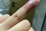 去除附体后嗜睡正常吗(附体走后身体会恢复正常吗)
