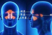 附见:副鼻窦炎症(附见副鼻窦炎症,双侧下鼻甲肥大,左侧乳突炎什么意思)