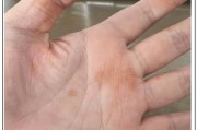附体严重的症状表现(附体是什么原因造成的)